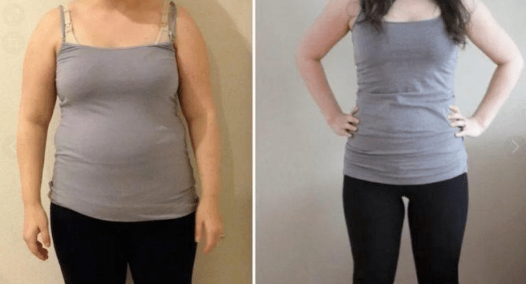 prieš ir po dukano dietos rezultatų